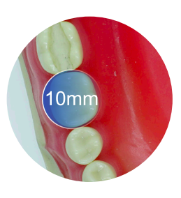 Producto ModuLite 